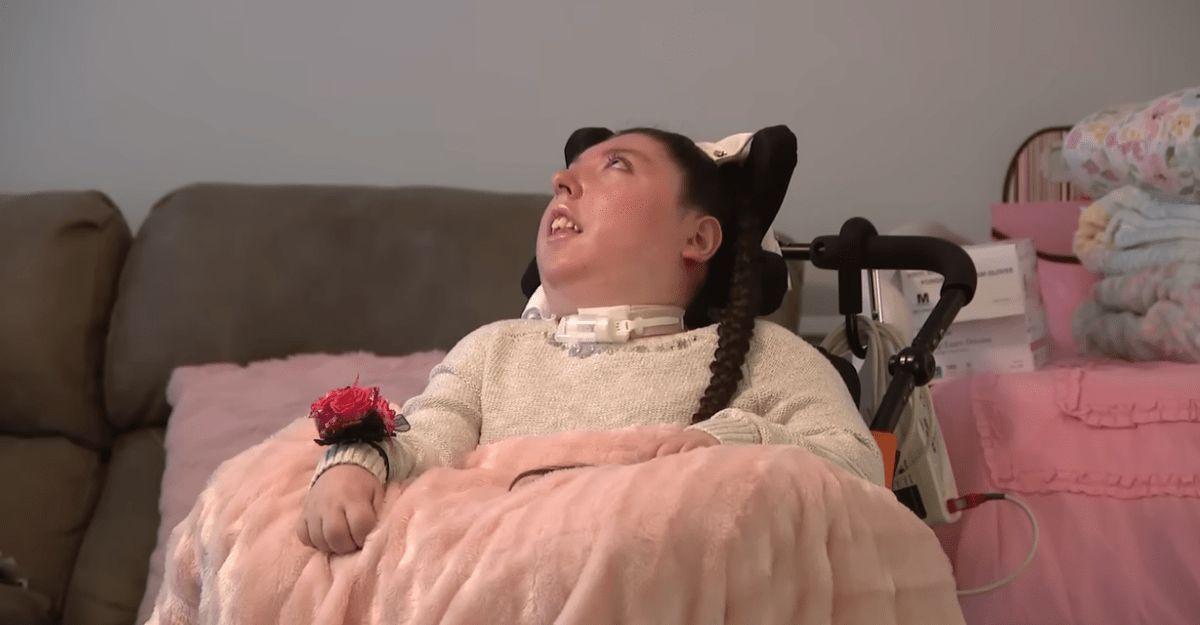 Jovem que nasceu sem cérebro completa 20 anos, contrariando previsão médica