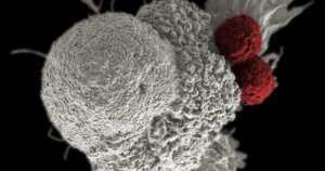 Célula com câncer pode proteger contra Alzheimer, aponta estudo